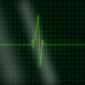 electrocardiogramme