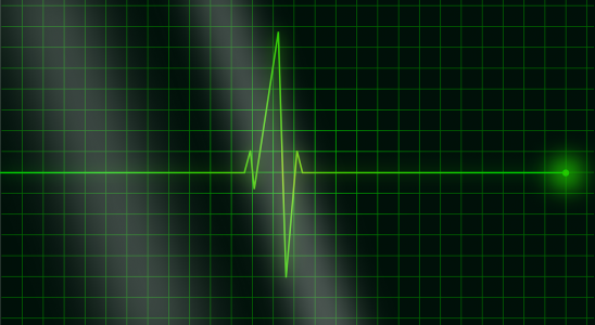 electrocardiogramme