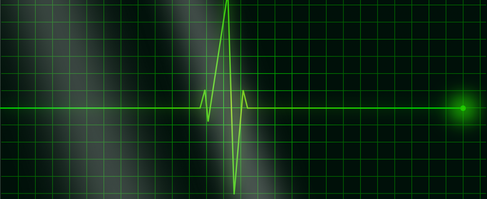 electrocardiogramme