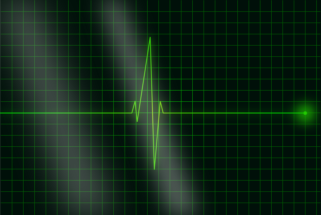 electrocardiogramme